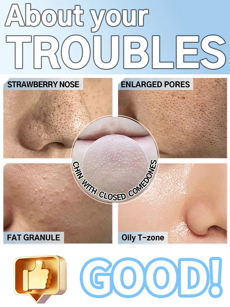 Face Cleansing Beauty Machine Dead Skin Remover Face Vacuum Blackhead Removal Skin